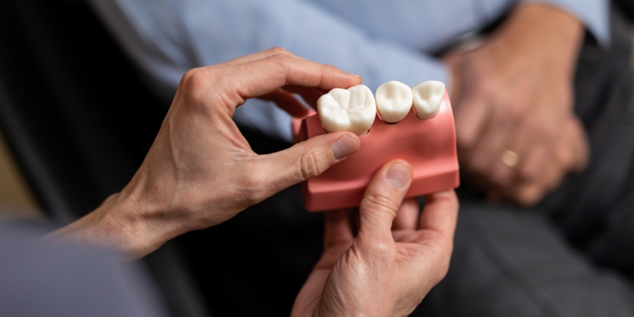 dental model showing wisdom tooth removal